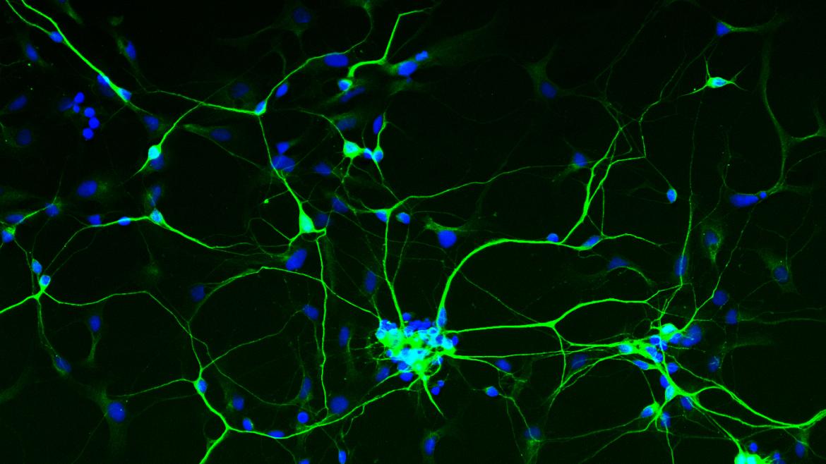 Human neurons that were derived from skin cells.