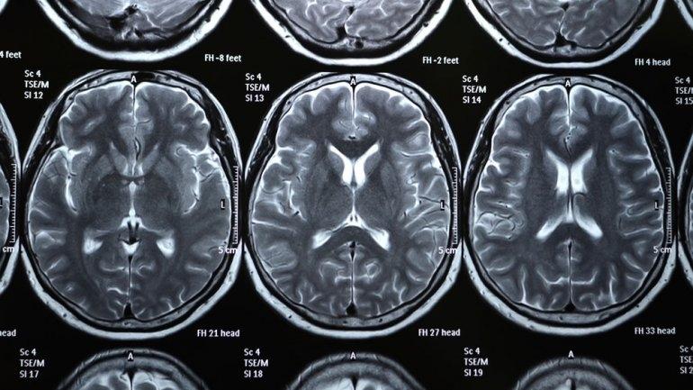 X-rays of the human brain