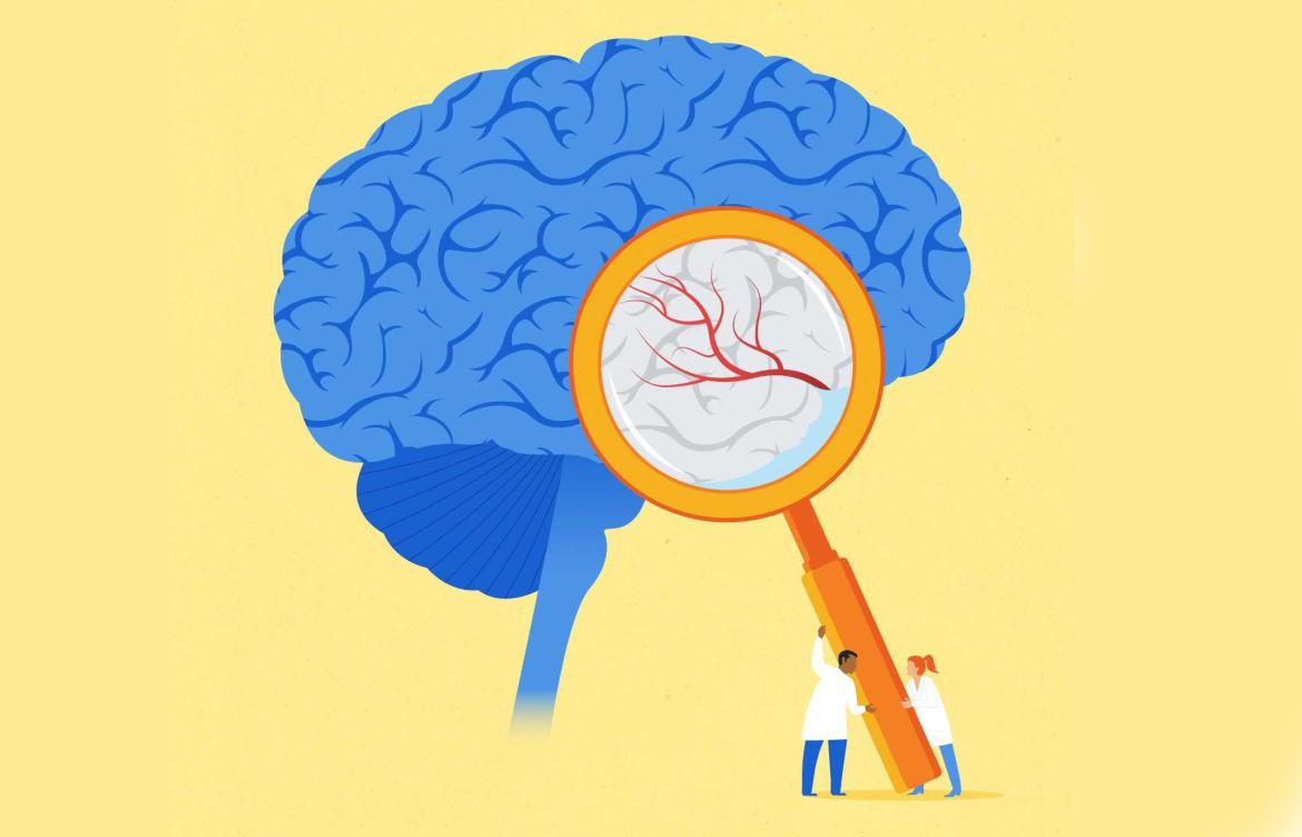 illustration of two scientists using a magnifying glass on an over-sized blue brain with plain yellow background