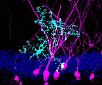 Image of microglia