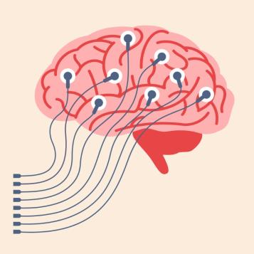 Illustration of a brain with electrodes attached to it